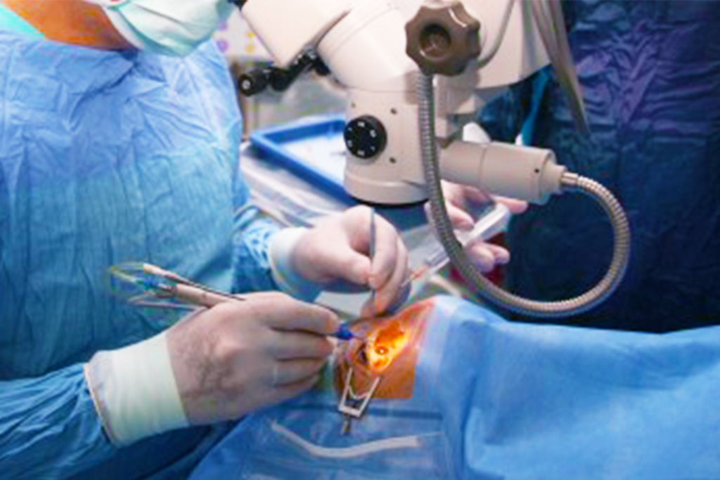 Chattishgarh Best Eye hospital